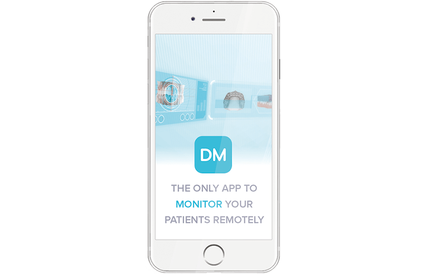 Dental Monitoring