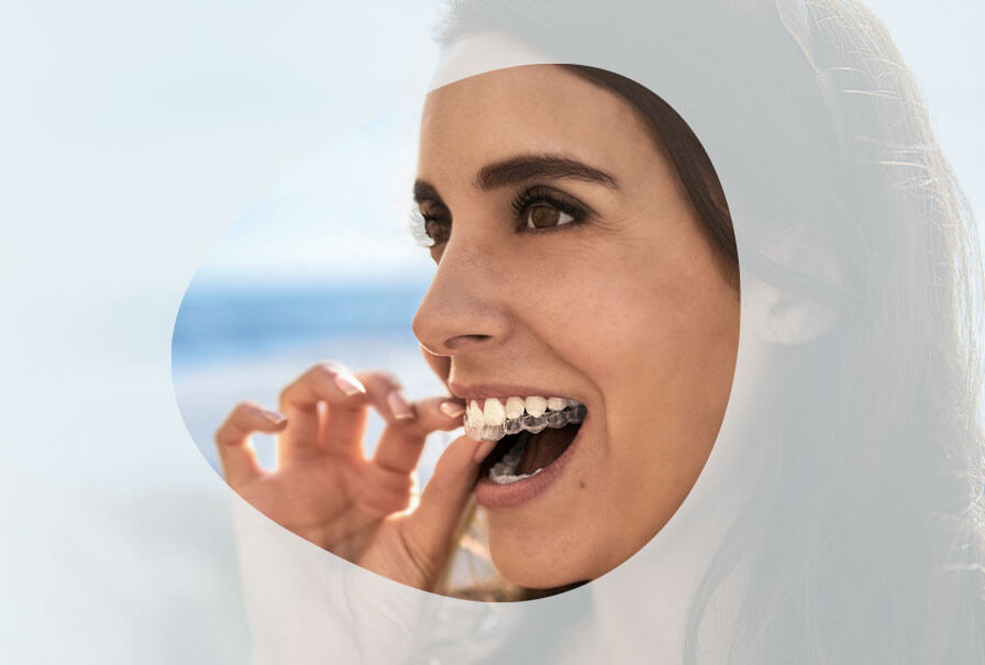 Invisalign Invisalign